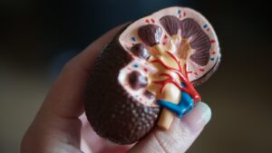 Chronic kidney disease cases have tripled among women