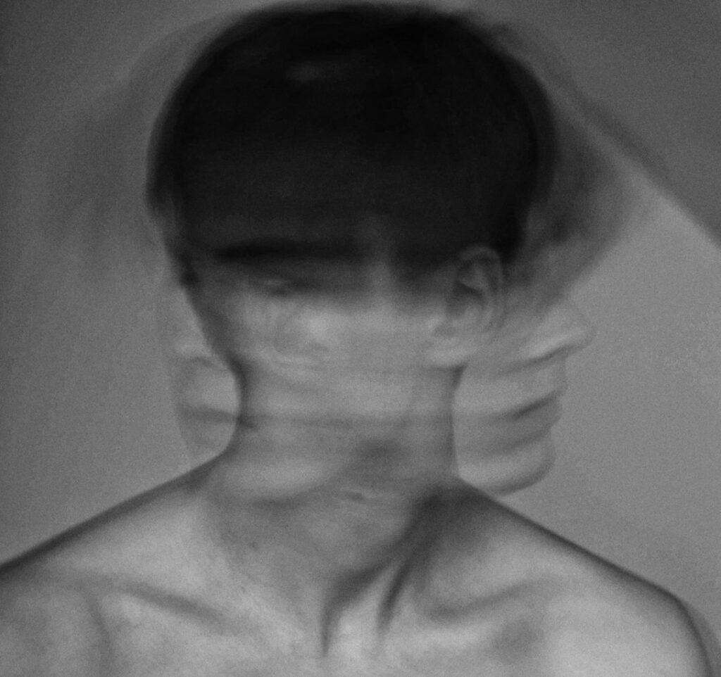 Severe mental illness shortens lives by up to 20 years, study finds