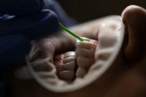Filling the gap: dentists to prioritise urgent care