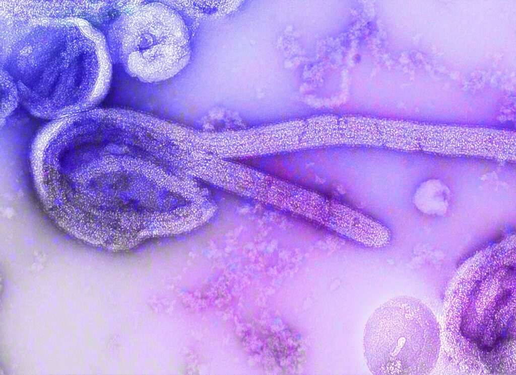 Journals make Ebola research free to access