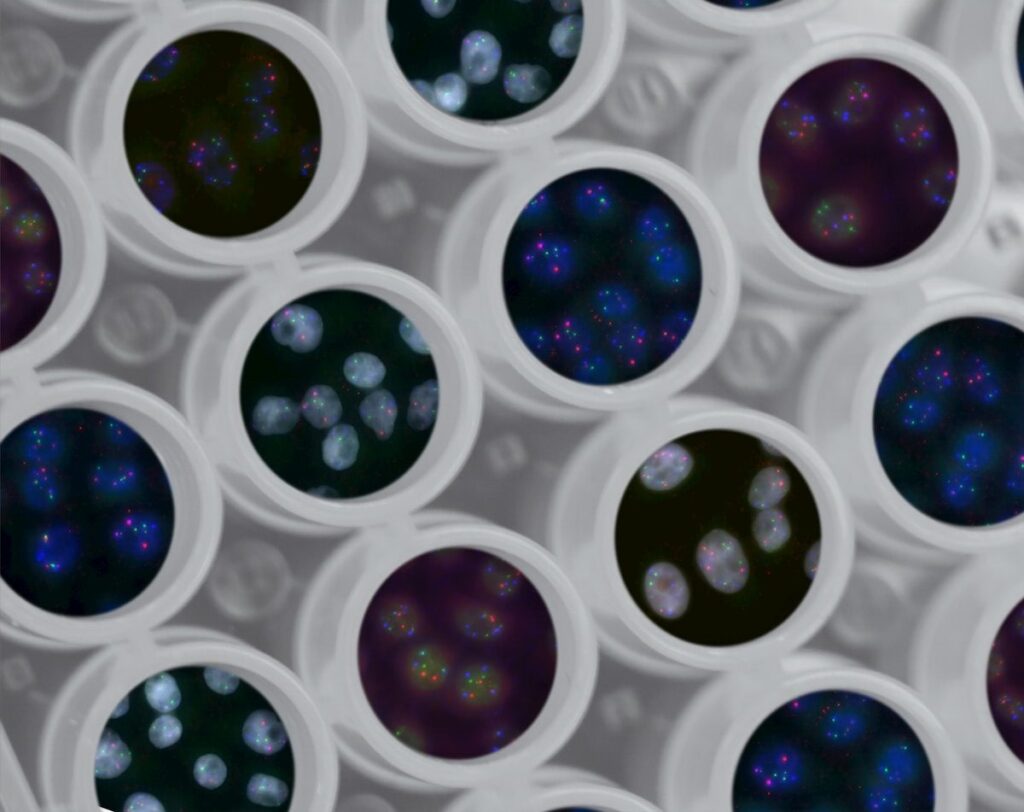 Leading neurology hospital joins UK’s first national digital pathology platform 