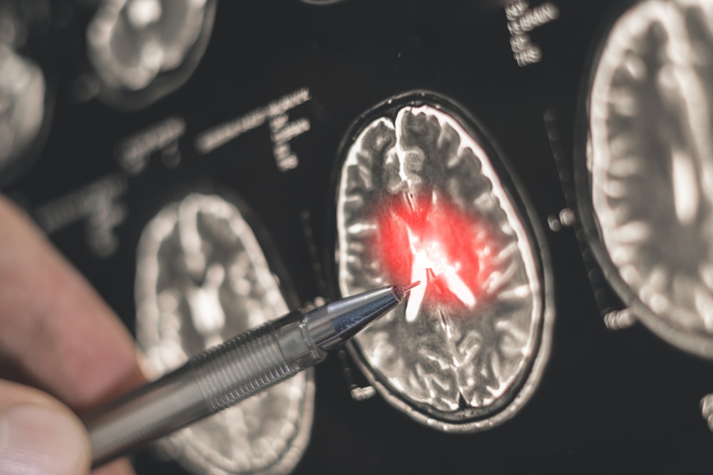 Government launches search for England’s first Dementia Tsar